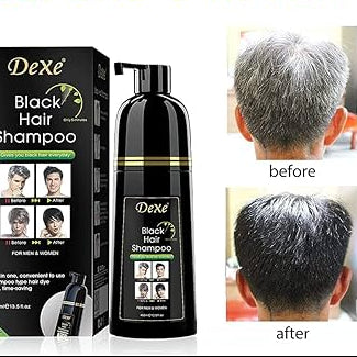 Champú tinte negro 2 en 1 – Elimina las canas al instante